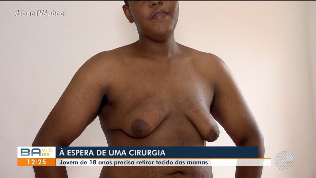 Direitos do Paciente no SUS: O Que Você Precisa Saber Antes da Cirurgia