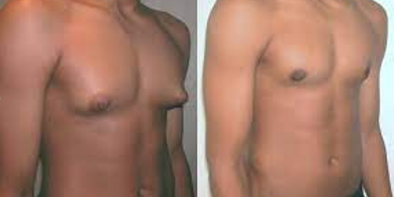 Hospitais Escola: Uma Alternativa para Cirurgias Plásticas Reparadoras no Brasil