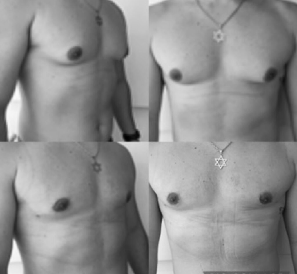 Como Funciona o SISREG: Guia Completo para Cirurgias pelo SUS