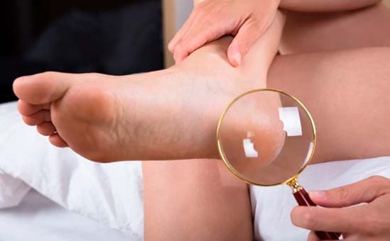 rotina de cuidados pés diabéticos