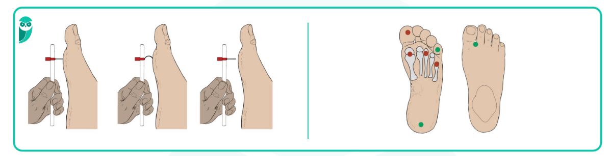 erros comuns inspeção pés diabetes
