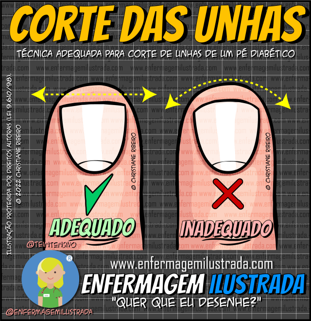 corte correto unhas pé diabético