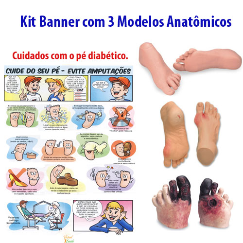 erros comuns que aumentam o custo do pé diabético