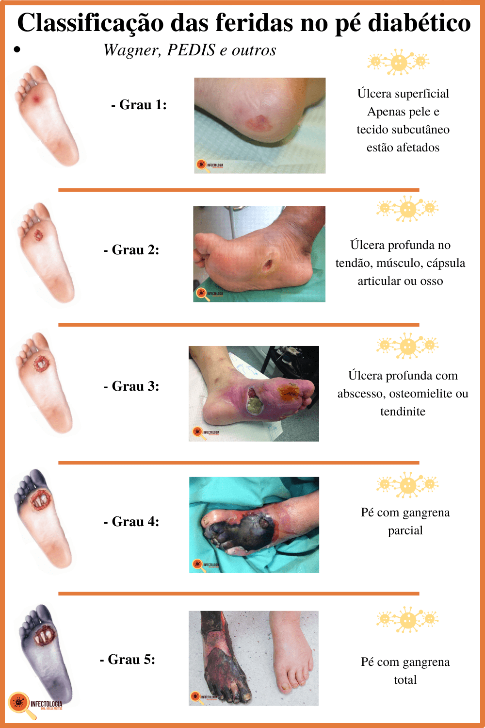erros comuns diabeticos pes neuropatia