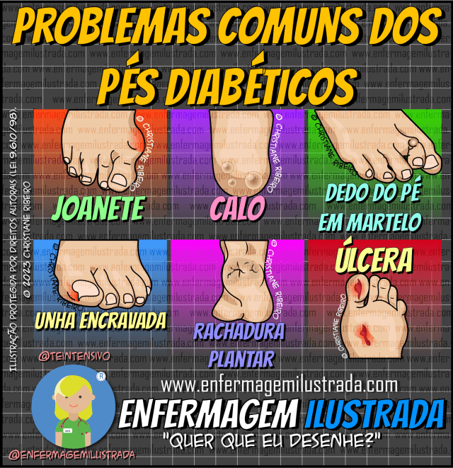 escalda pes diabetes riscos e erros comuns