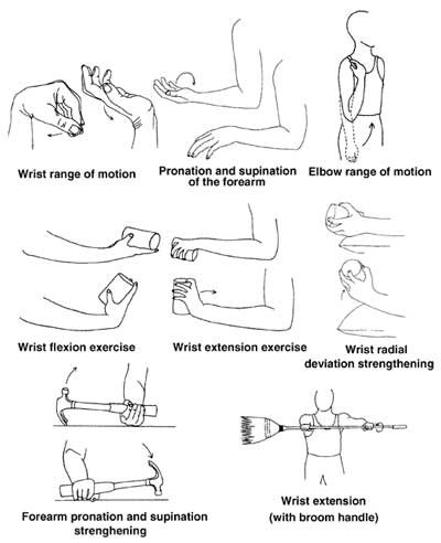 Guia Completo: Exercícios para Aliviar a Dor do Cotovelo de Tenista