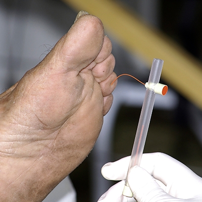 5 dicas essenciais para cuidar dos pés diabéticos