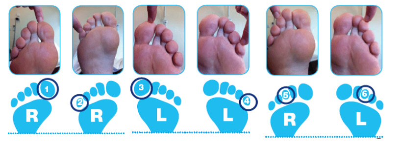 dicas para viver bem neuropatia diabética pés