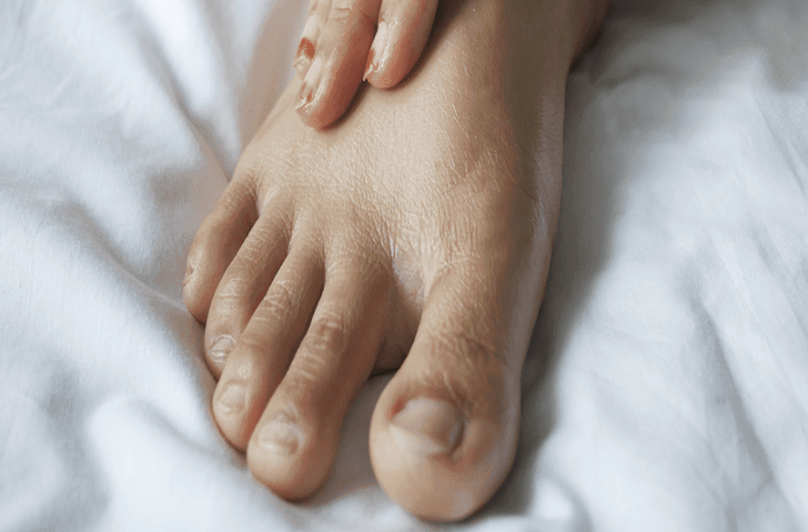 o que acontece se diabético faz escalda pes errado