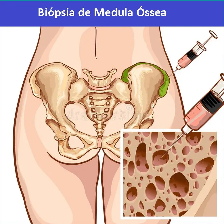 A importância da medula óssea para a produção de sangue