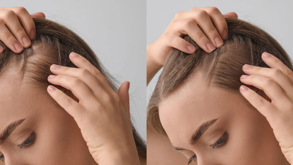 os cabelos crescer rapido