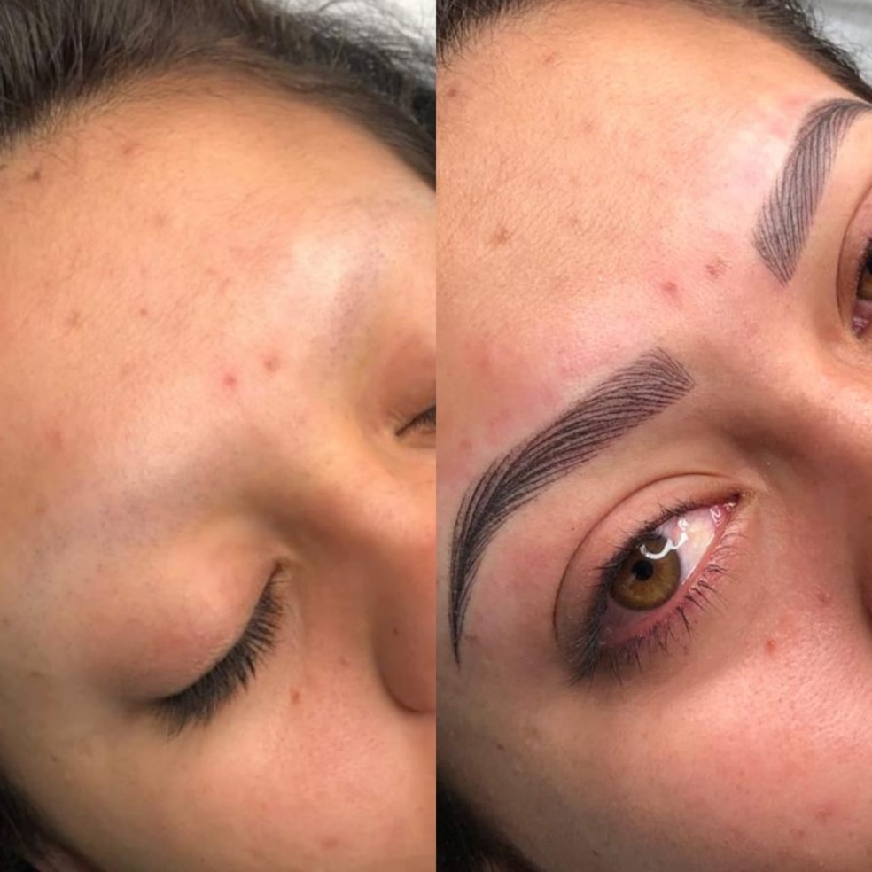 Microblading vs Nanopigmentação: Qual a Melhor Técnica para Você?