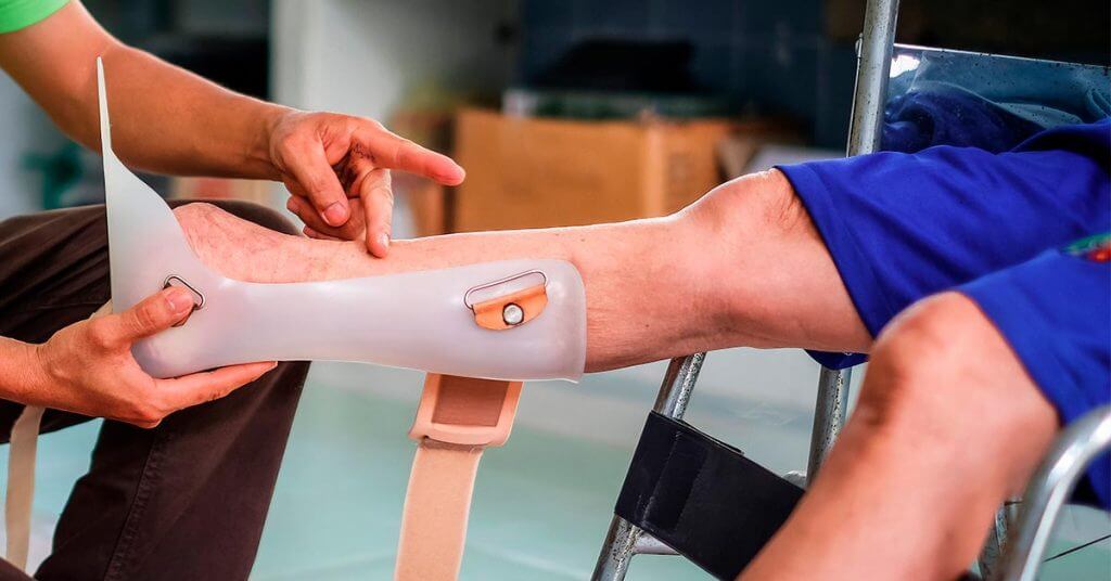 сколько стоит операция по ампутации стопы при диабете