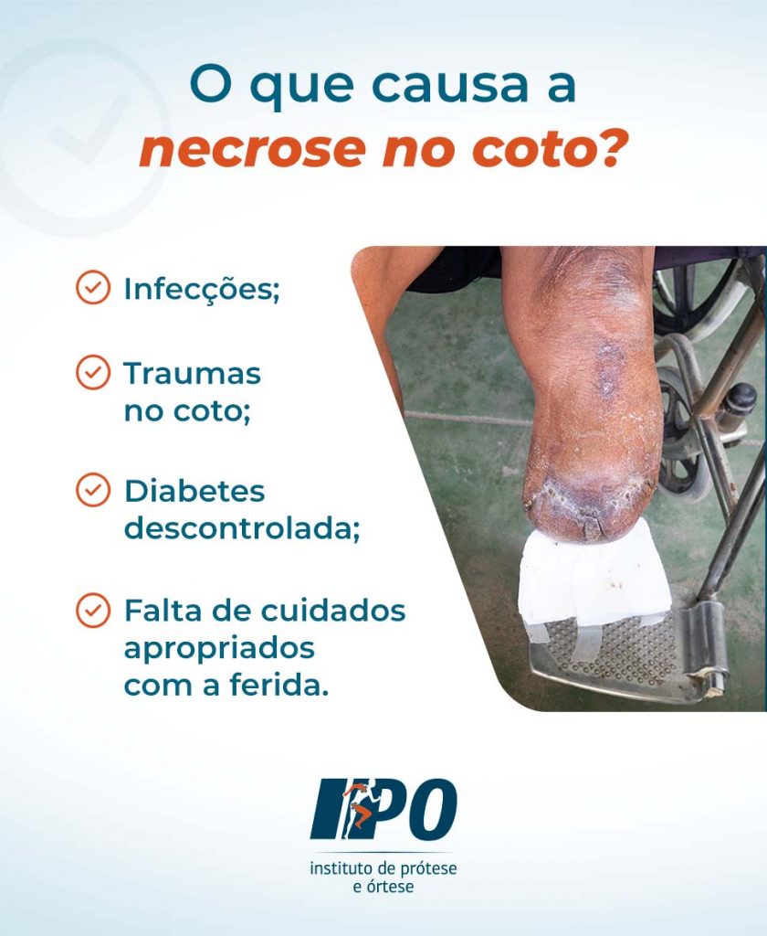 5 шагов, чтобы избежать ампутации при диабетической стопе